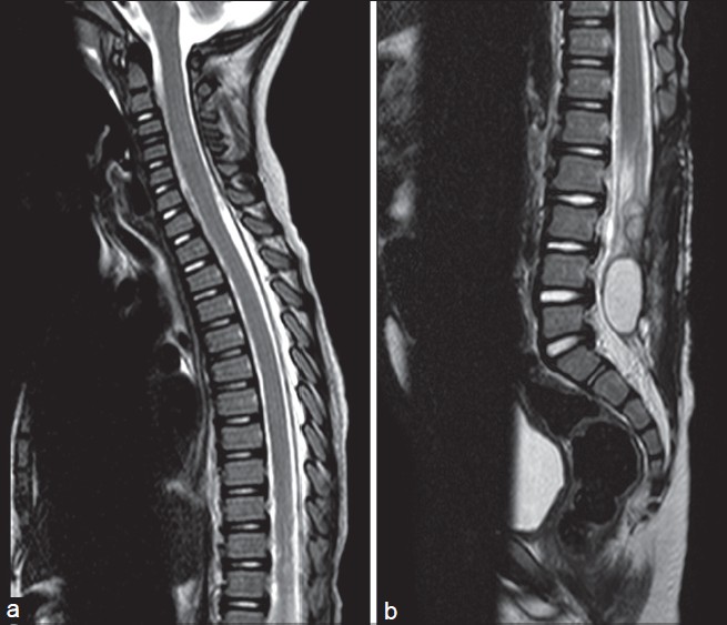 What is MRI? (Magnetic resonance imaging)