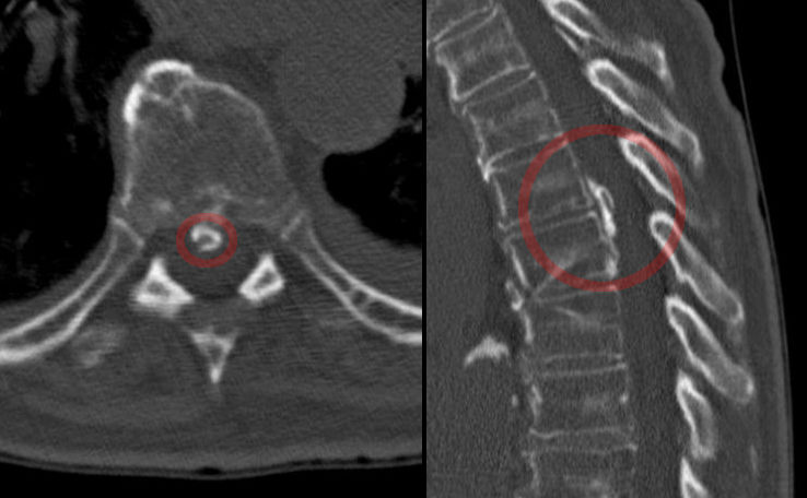 What is X-ray